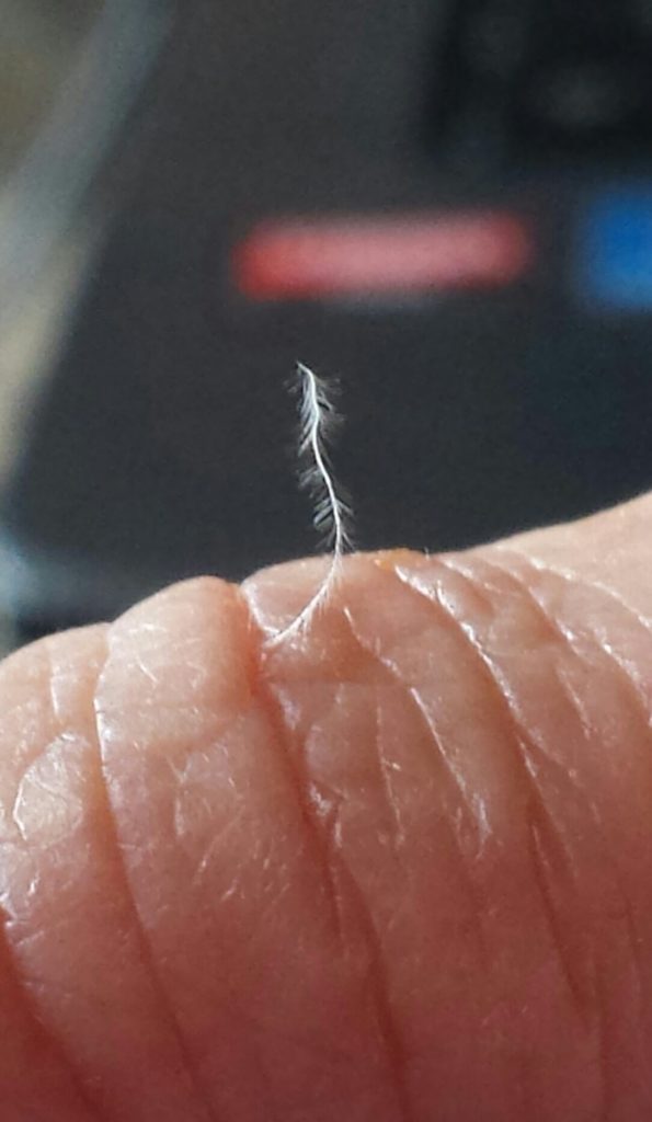Morgellons disease photo : Feather-like filament