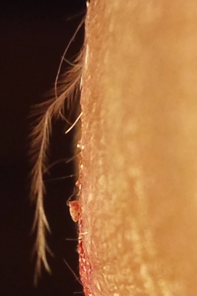 Morgellons disease photo : Another feather-like filament