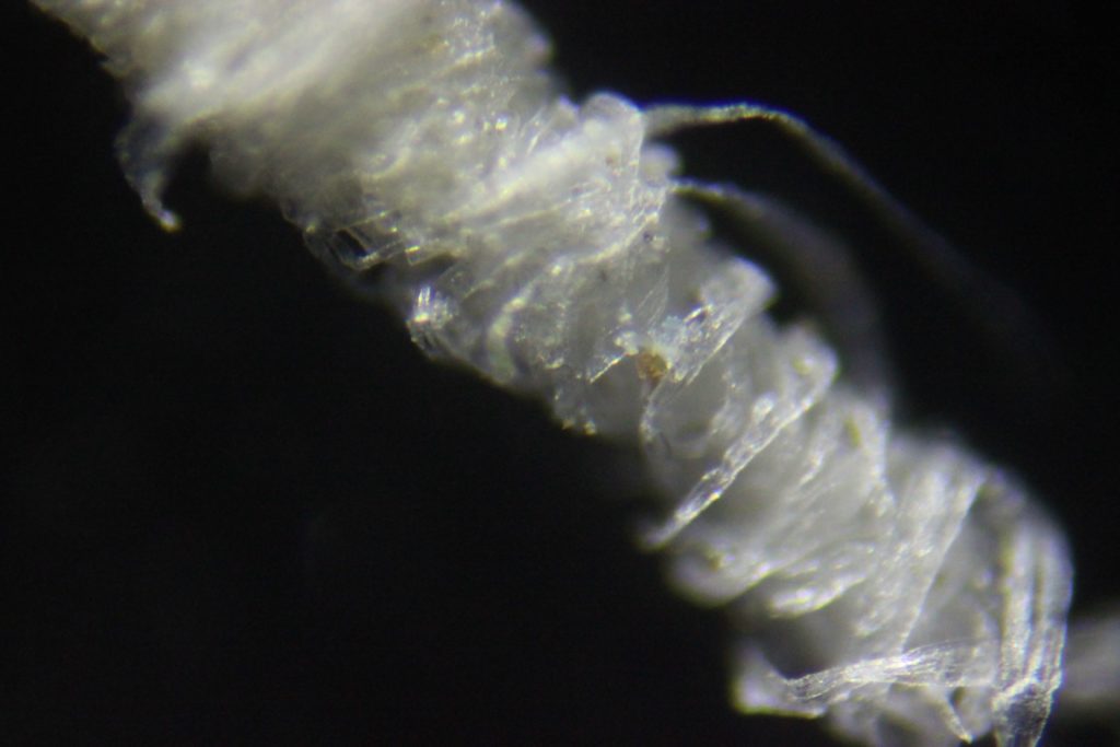 Morgellons disease photo : Filaments tightly wound around a hair at 200X magnification