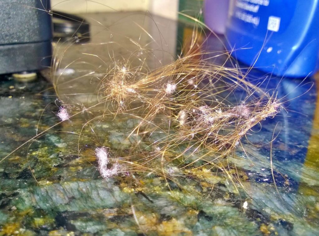 Morgellons disease photo : Filaments tightly wind around follicular hair sheaths