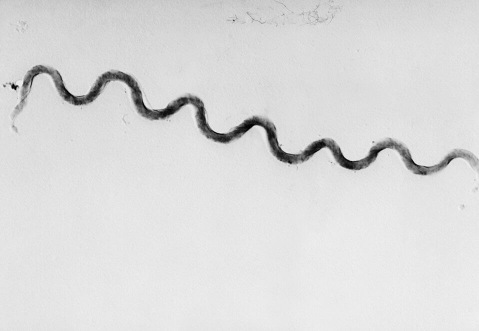 Morgellons disease photo : Photomicrograph of a spirochete